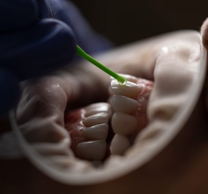 przyczyny złamanych i uszkodzonych zębów